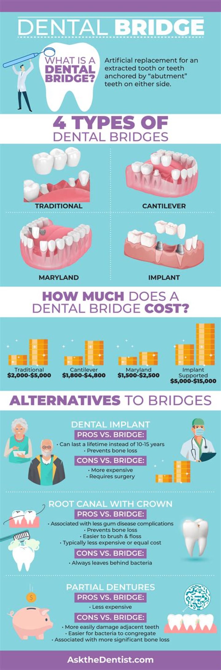 How much is a dental bridge?