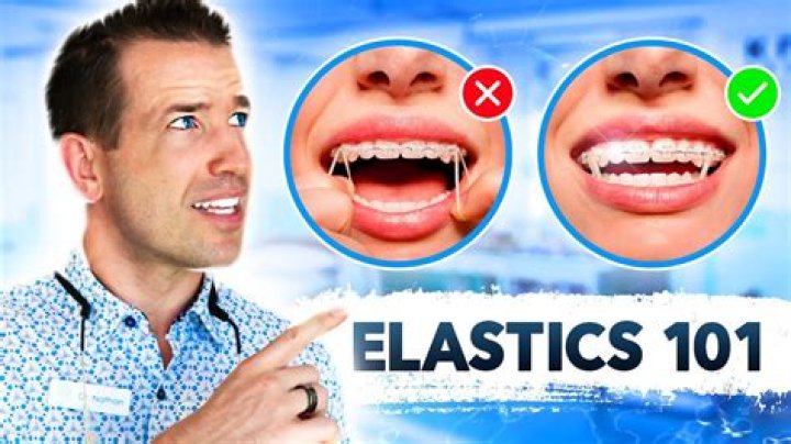 How often should i change my elastics?