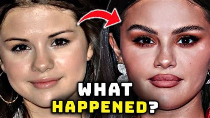 How pedro gomez died?