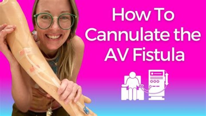 How to cannulate yourself?