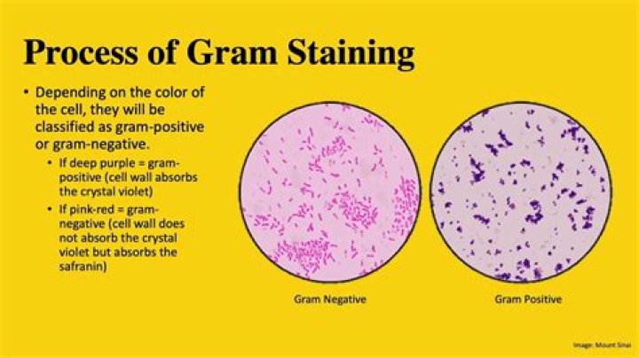 How to determine gram positive or negative?