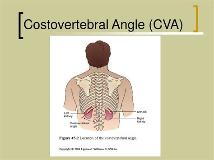 How to explain costovertebral angle?