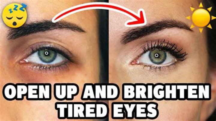 How to make your eyes unswollen?