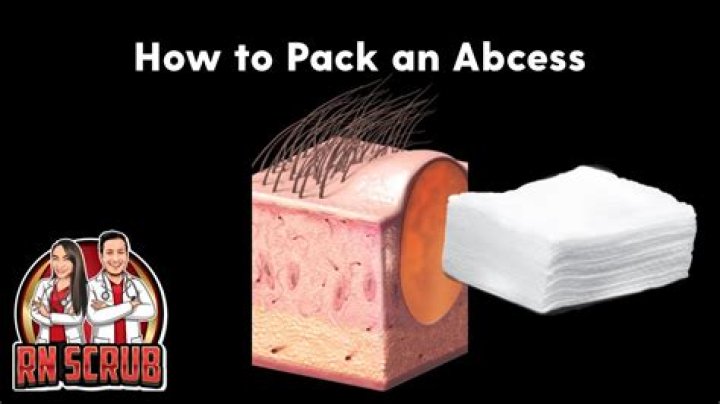How to pack a perianal abscess?