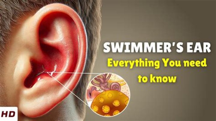 How to prevent swimmer's-ear in child?