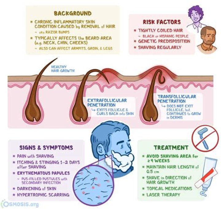 How to prevent sycosis barbae?