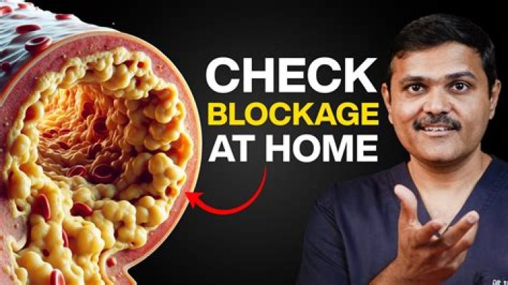 How to treat claudication at home?