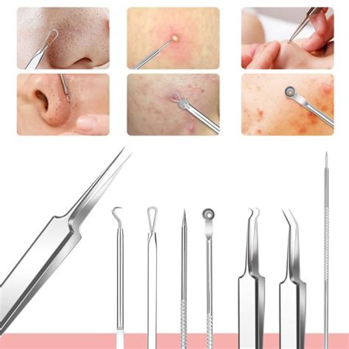 In ear blackhead removal?