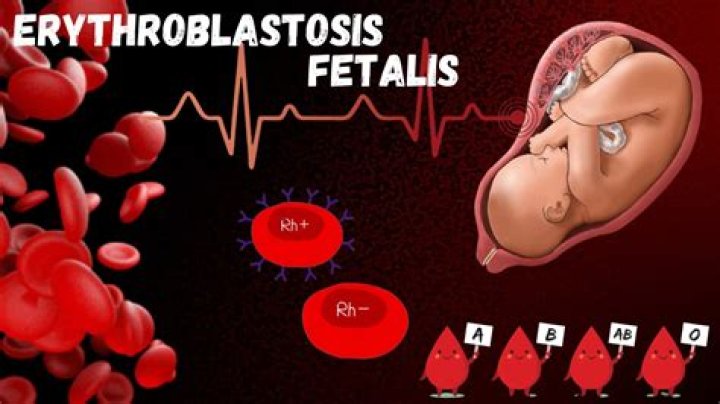 In erythroblastosis fetalis mother is?