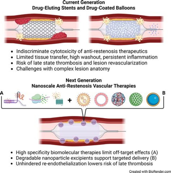 In stent thrombosis classification?