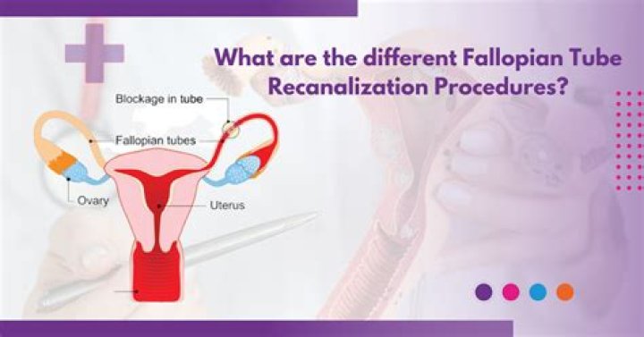 In which part of fallopian tube fertilization takes place?