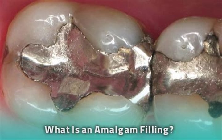Is amalgam an element?