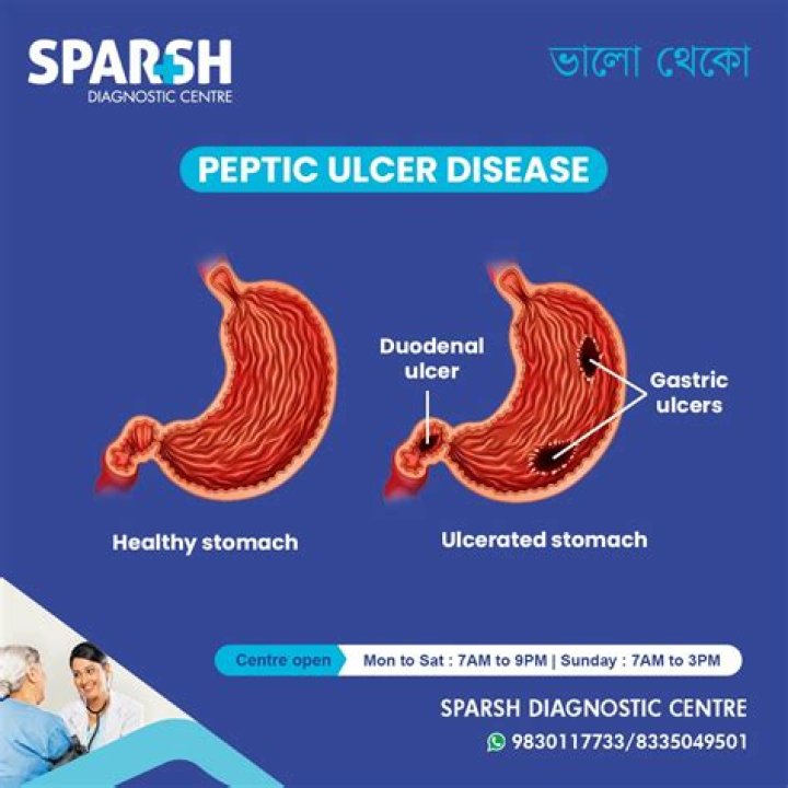 Is garlic good for peptic ulcer?