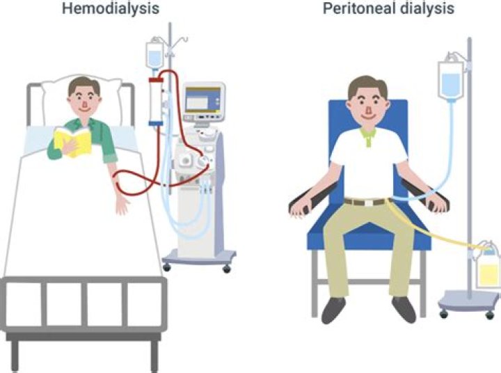 Is hemodialysis better than peritoneal?
