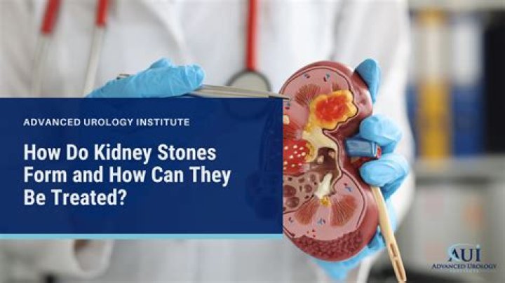 Is honey okay for kidney stones?