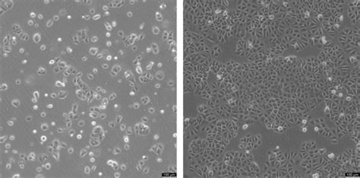 Is mcf 7 triple negative?