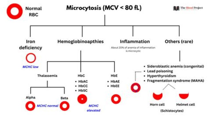 Is microcytic hypochromic anemia fatal?