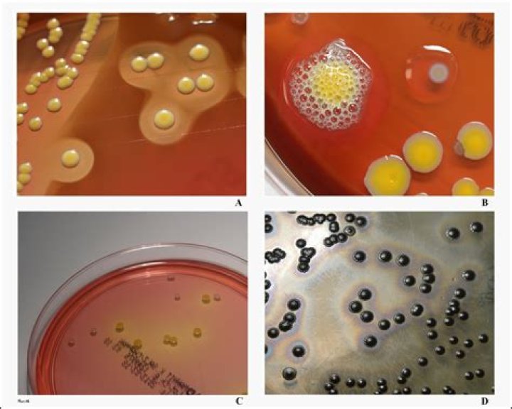 Is staphylococcus catalase positive?