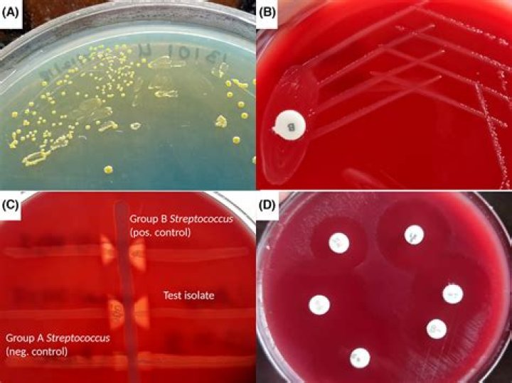 Is streptococcus a pathogenic or nonpathogenic?