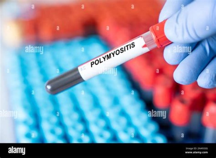 Is there a blood test for polymyositis?
