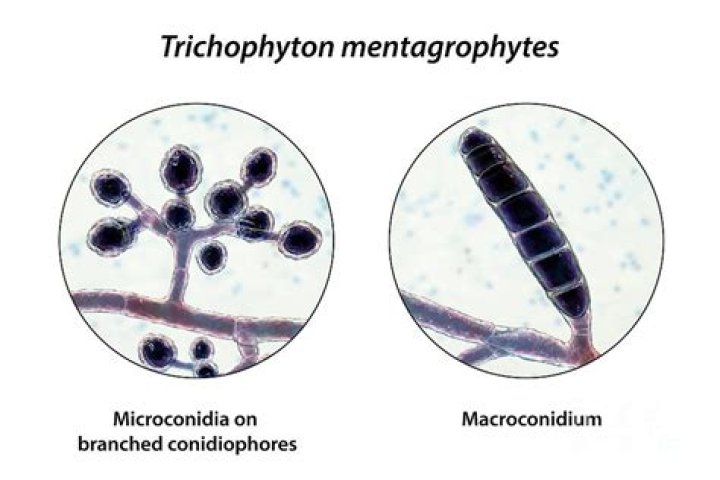 Is trichophyton rubrum a yeast or mold?