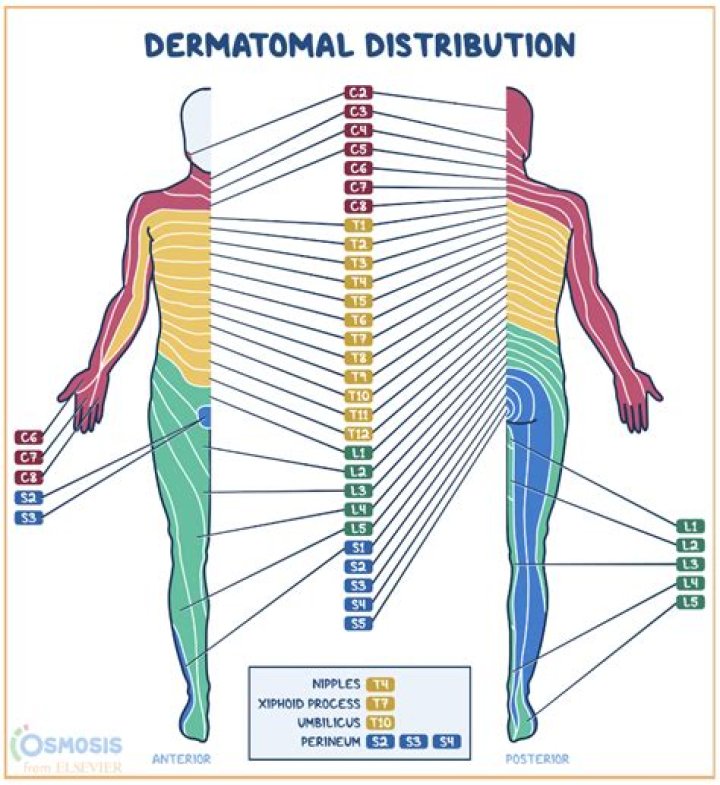On a dermatomal distribution?