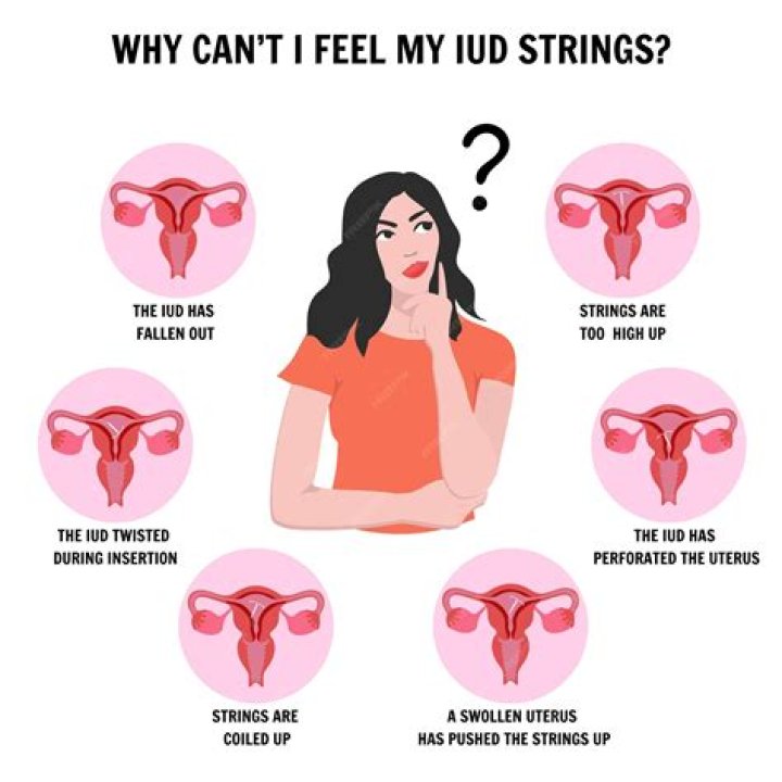 Should i be able to feel my iud?