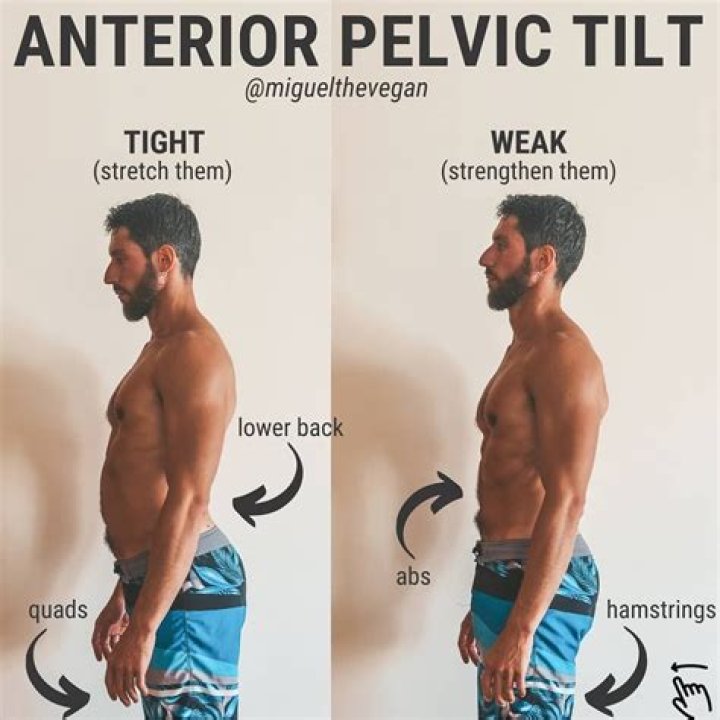 Should i deadlift with anterior pelvic tilt?