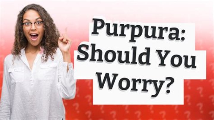 Should i worry about purpura?