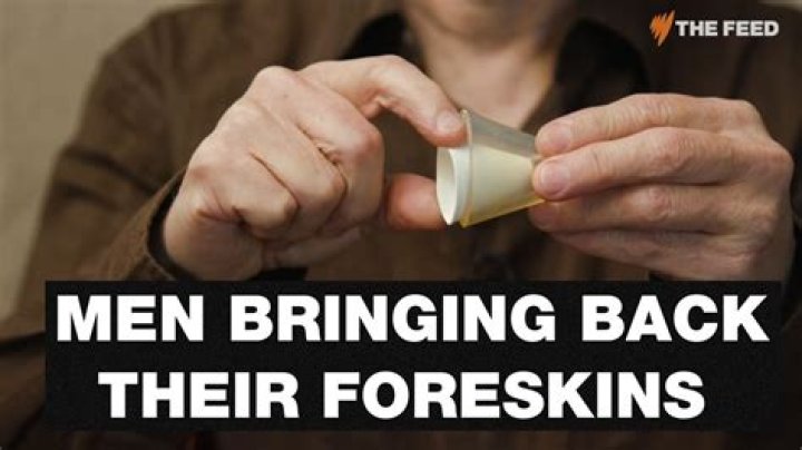 Should my foreskin always be pulled back?