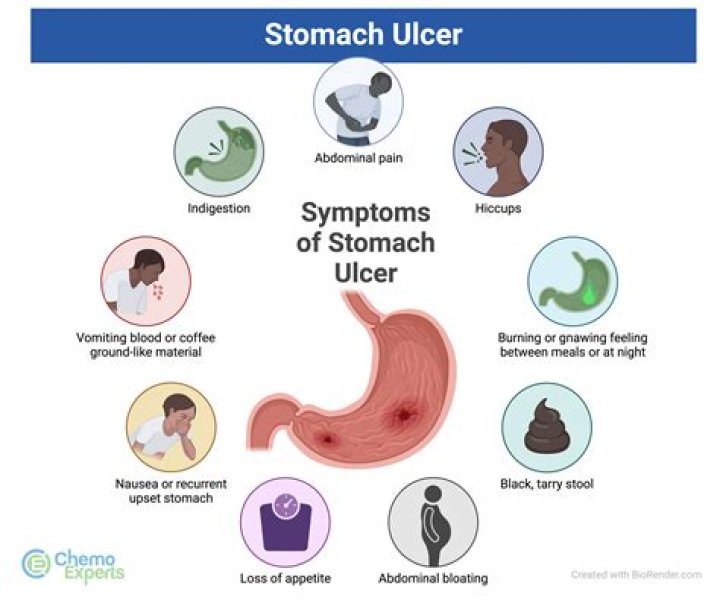 Should you go to er for ulcer?