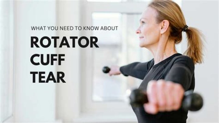 Should you immobilize a rotator cuff injury?