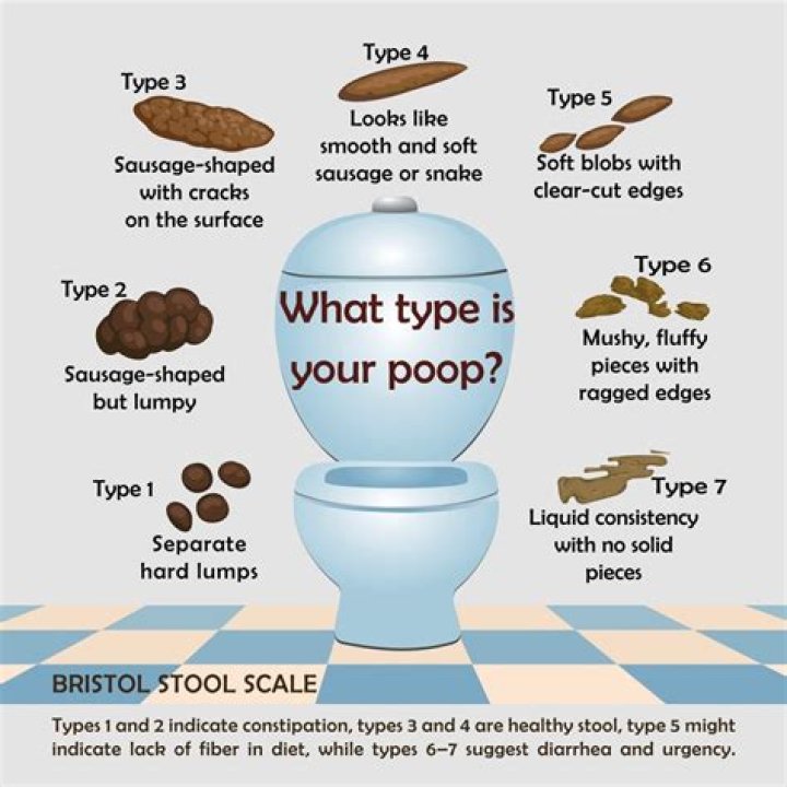 Should you poop everyday?