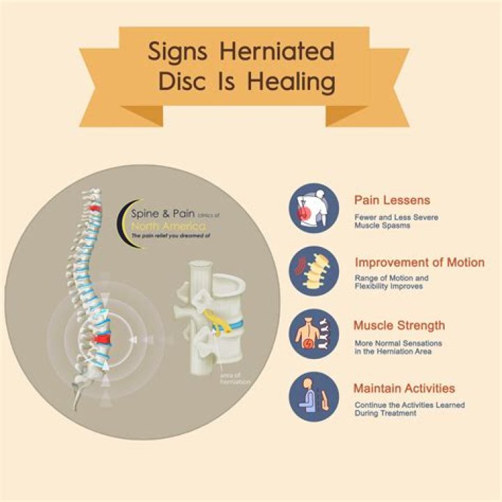 Should you run with a herniated disc?