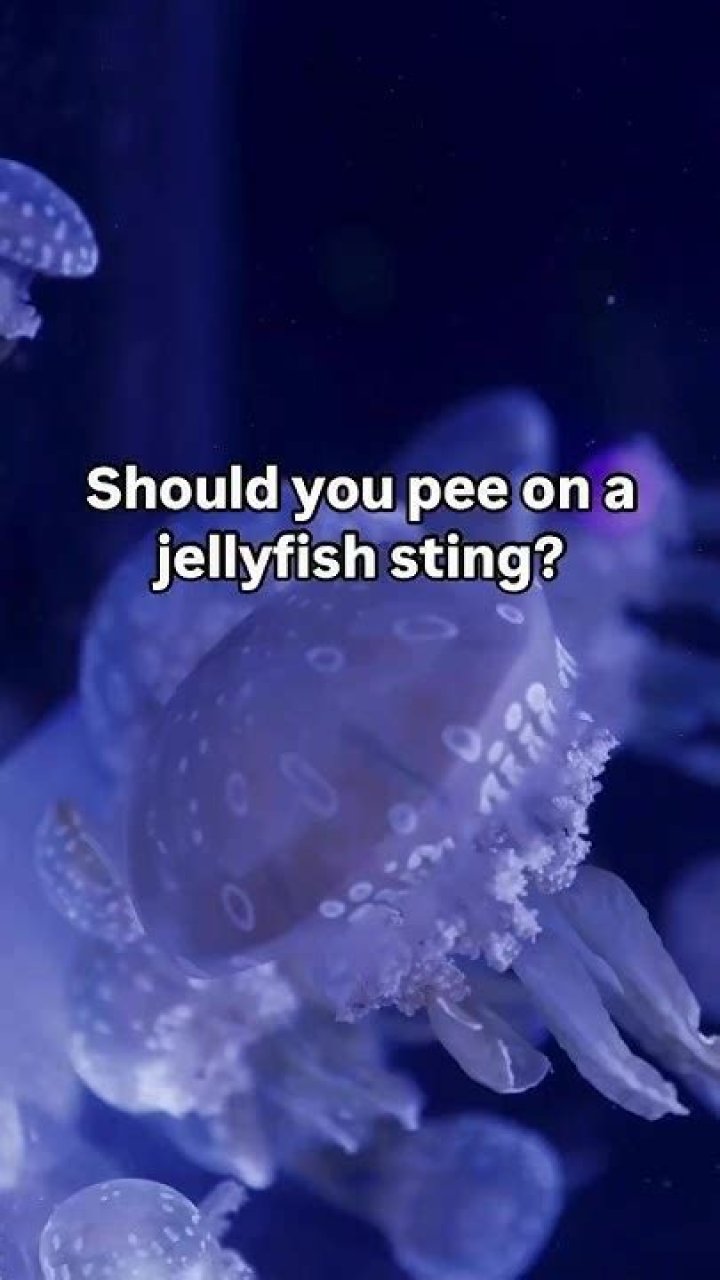 Should you wee on a jellyfish sting?