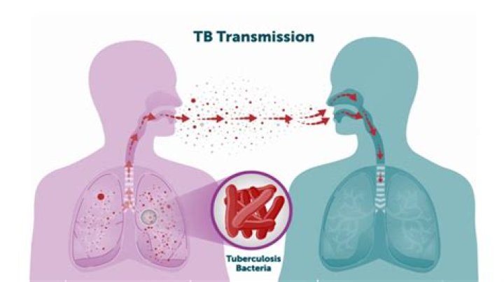 Was tb an epidemic?