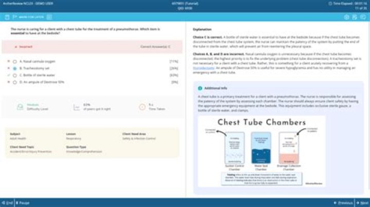 Was uworld harder than nclex?