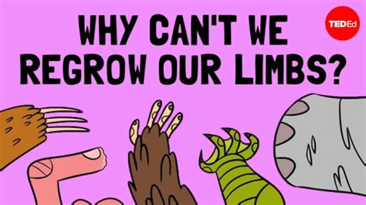 Were are your limbs?