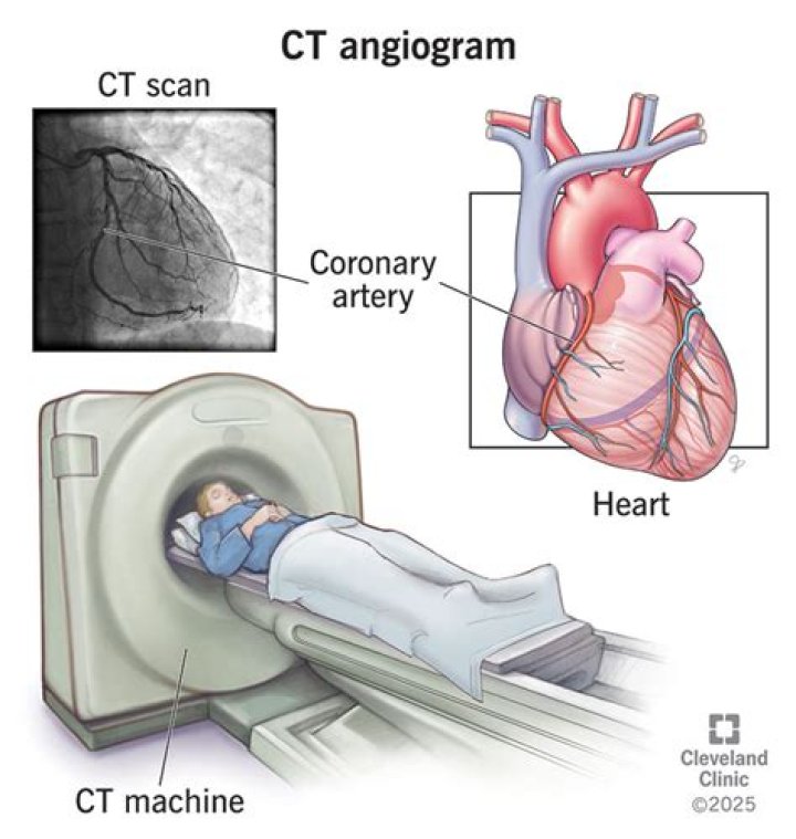 What angiography of heart?