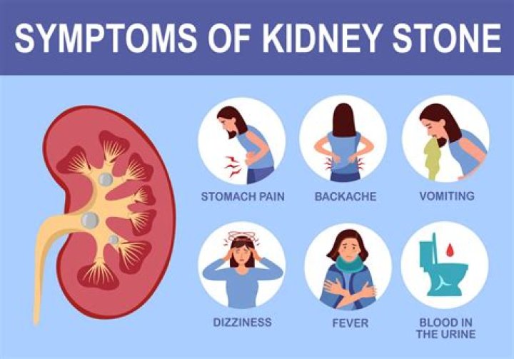 What are the symptoms of a kidney stones?