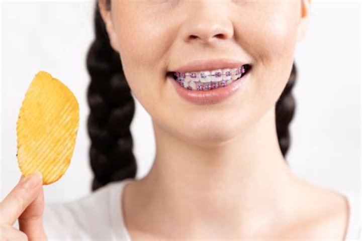 What chips can you eat with braces?