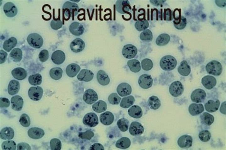 What do u mean by supravital stain?