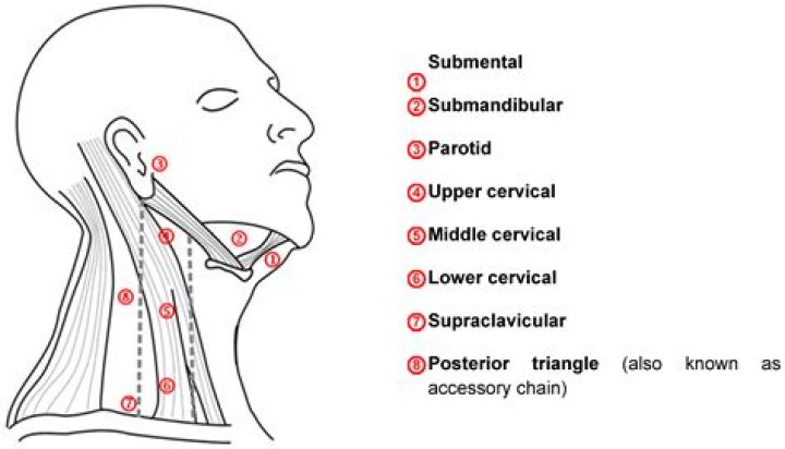 What does a supraclavicular node feel like?