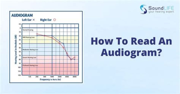 What does an audiogram test for?