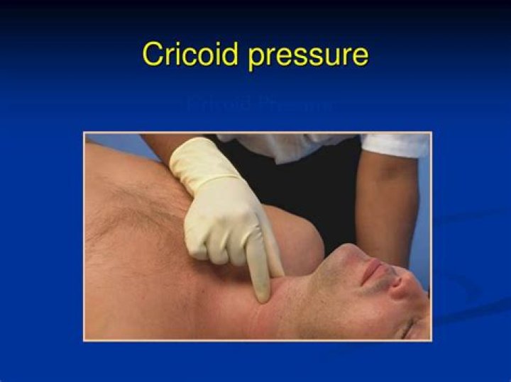 What does cricoid pressure do?