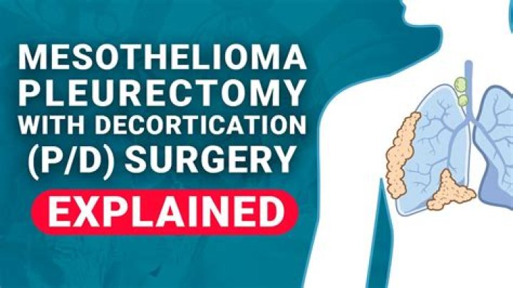 What does pleurectomy mean?