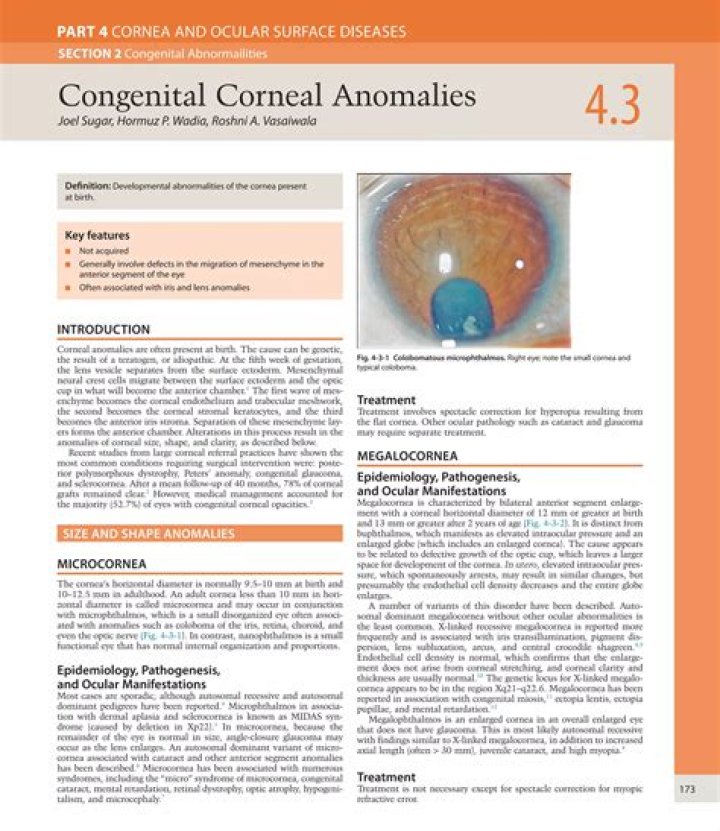 What does sclerocornea mean?