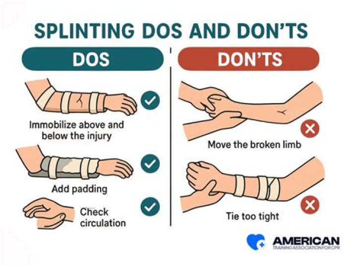What does splintage meaning?