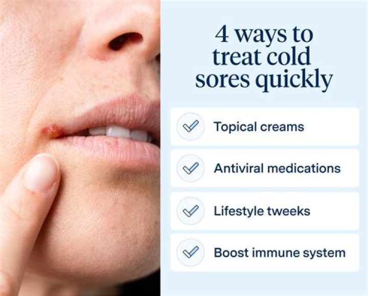 What dries out cold sores?