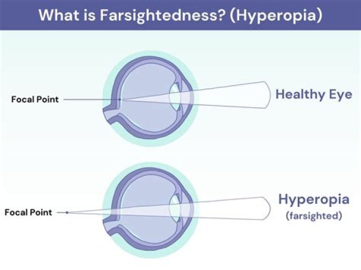What farsighted looks like?